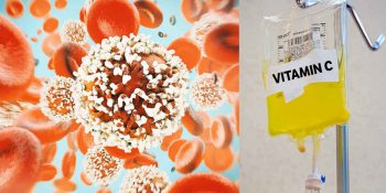 Vitamin-C-Hochdosis Infusionstherapie: